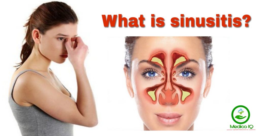 Sinus Infection Sinusitis Sinus Infection Symptoms Sinus Infection Sinusitis Sinus Infection Symptoms