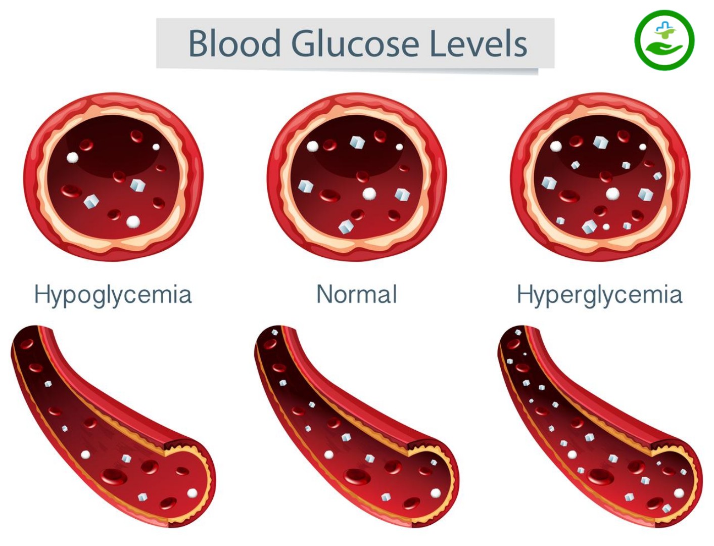 diabetes diagnosis test